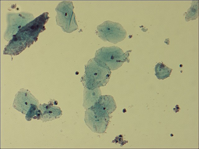 Gardnerella Vaginalis